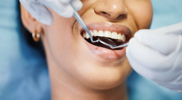 Best Emergency Treatment for Toothache in Little Falls, NY